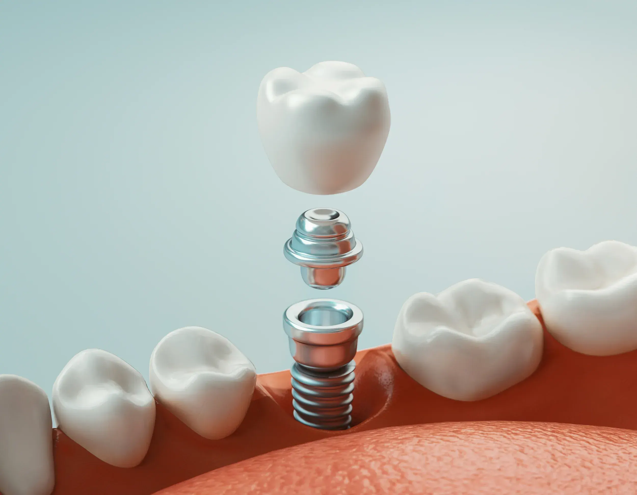 Restorative Dentistry