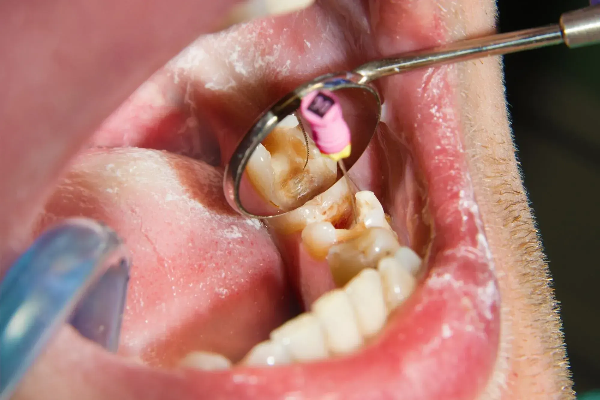 Dr. David Settel and team in the treatment area at East Ellijay Family and Cosmetic Dentistry