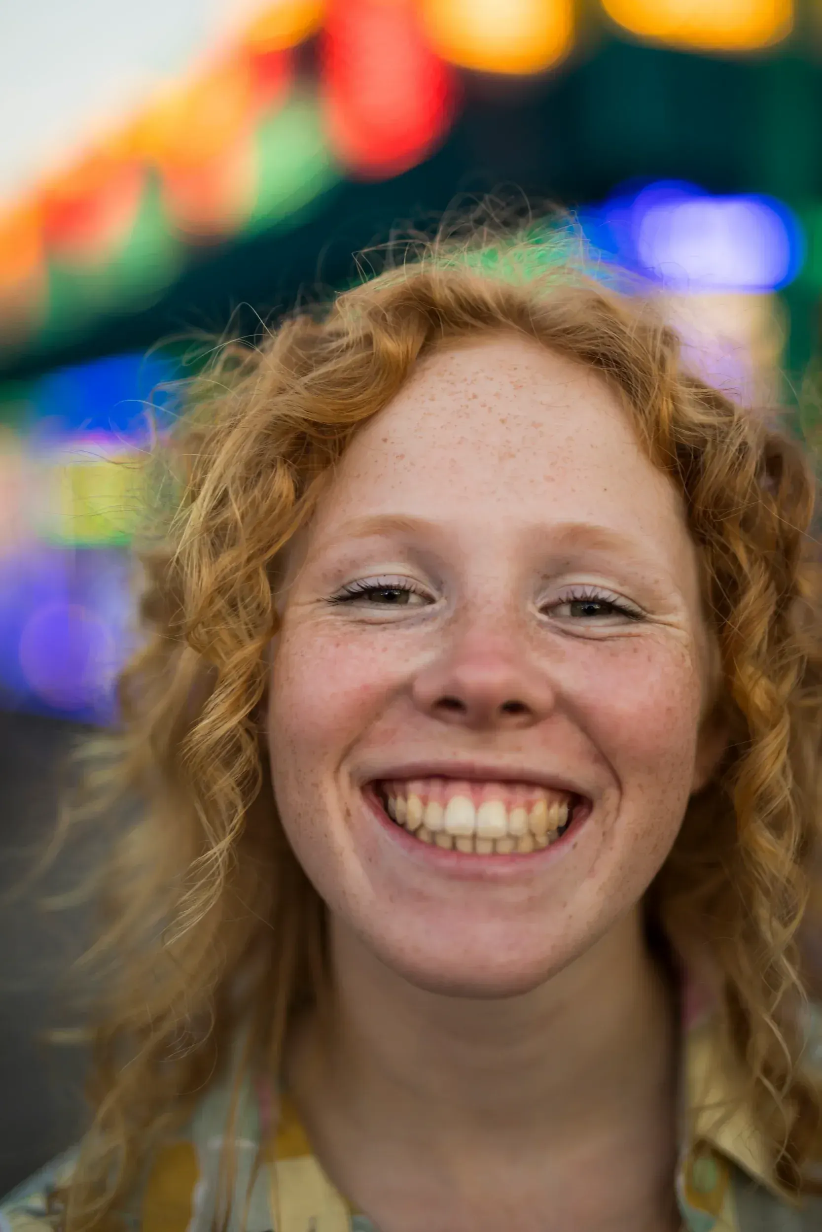Close-up of yellowing teeth shade comparison at East Ellijay Family and Cosmetic Dentistry