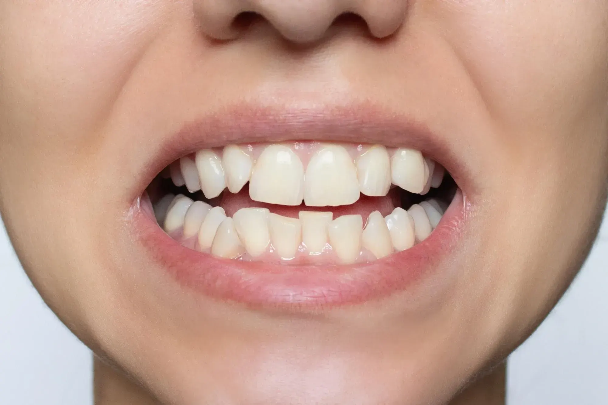 East Ellijay Family and Cosmetic Dentistry treatment room in East Ellijay Georgia