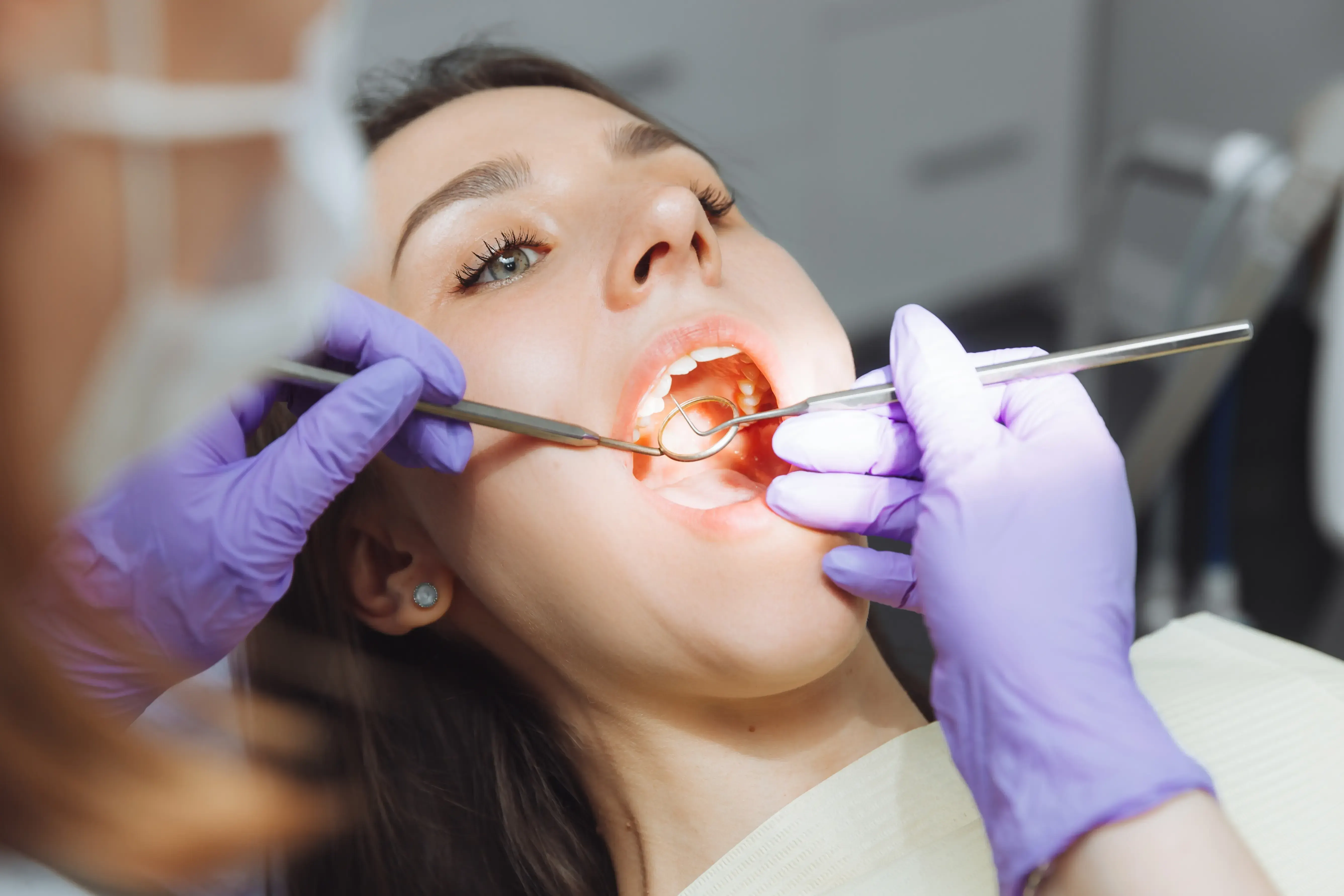 What Are Tooth-Colored Fillings?