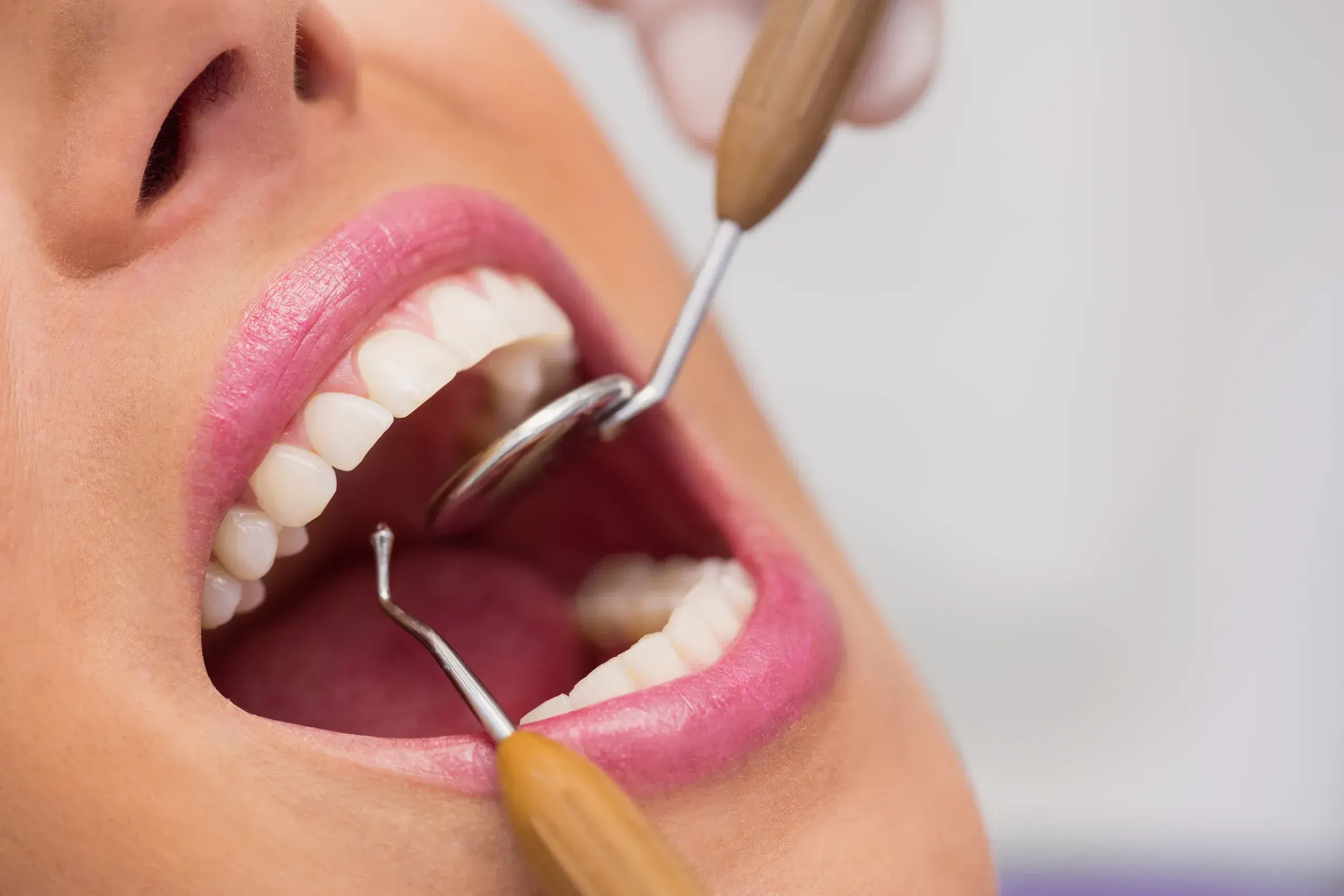Dental Implants Give You Back Your Smile