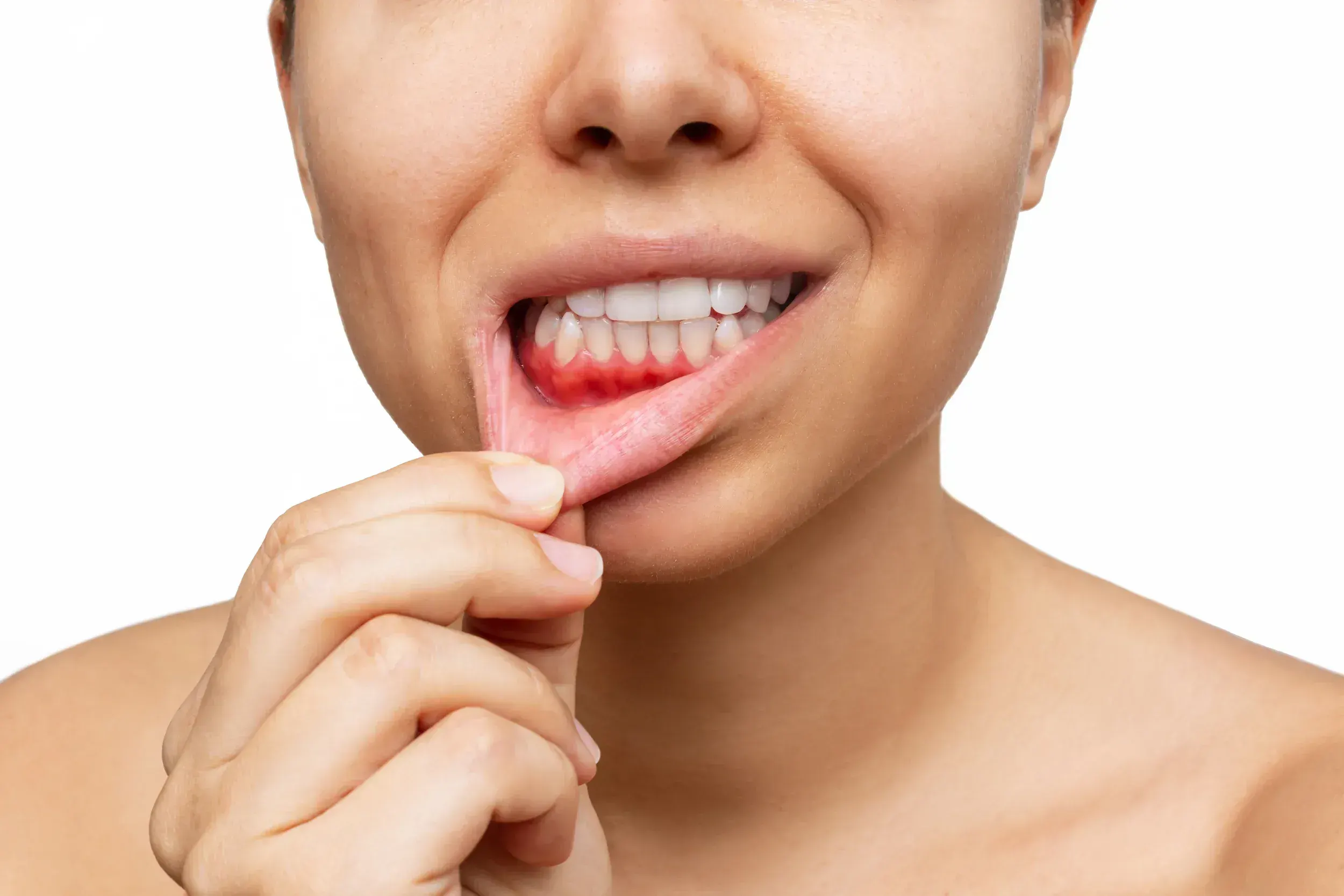 Patient receiving periodontal evaluation at East Ellijay Family & Cosmetic Dentistry in East Ellijay GA