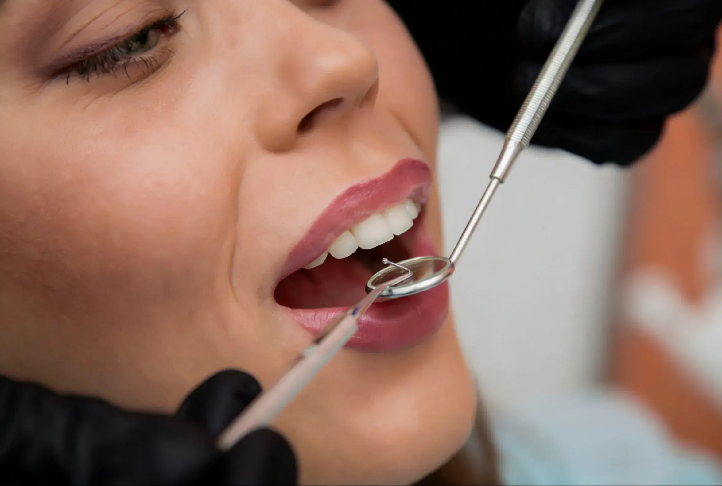 Dental crowns treatment at East Ellijay Family and Cosmetic Dentistry in East Ellijay GA
