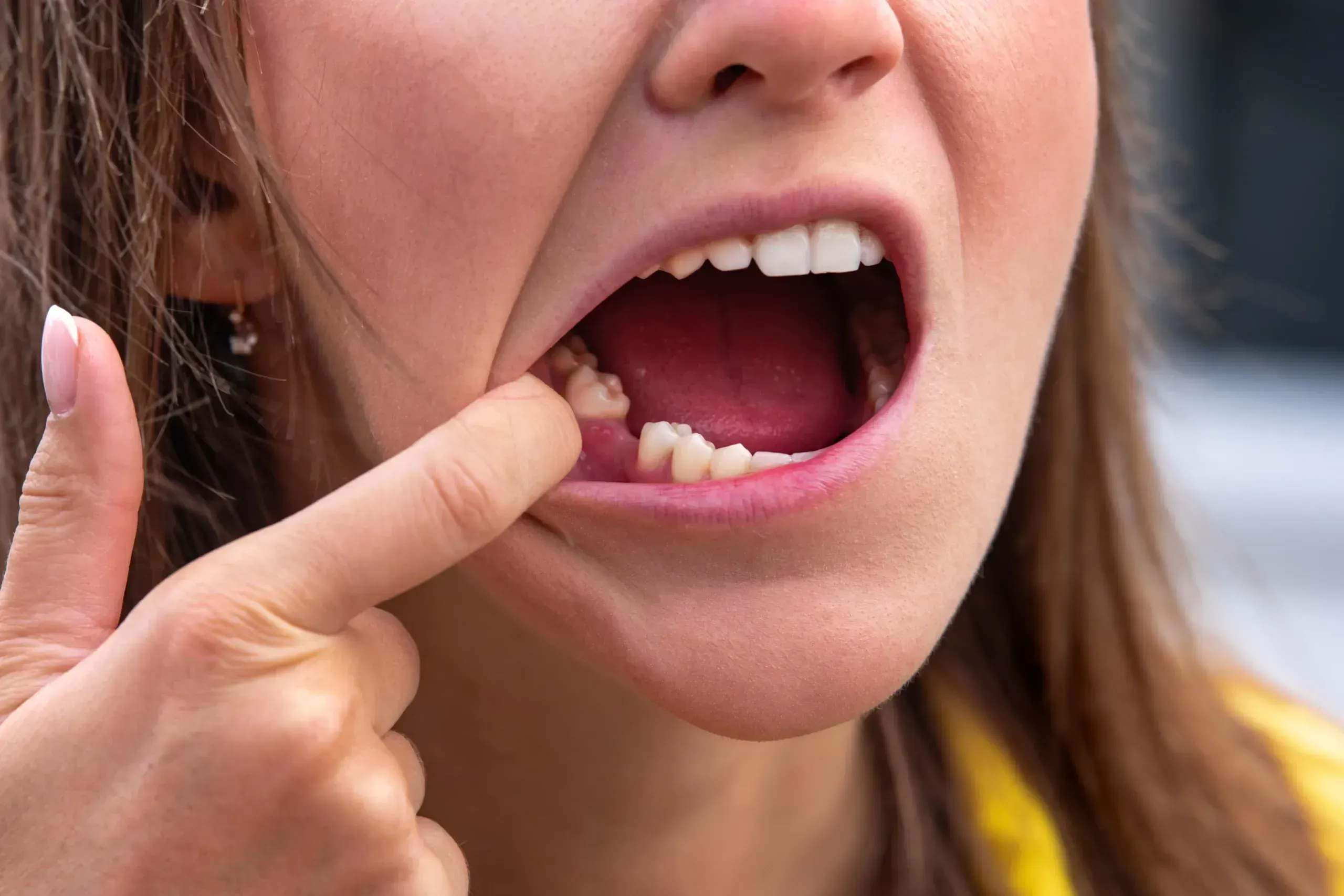 Patient discussing missing tooth options at East Ellijay Family & Cosmetic Dentistry