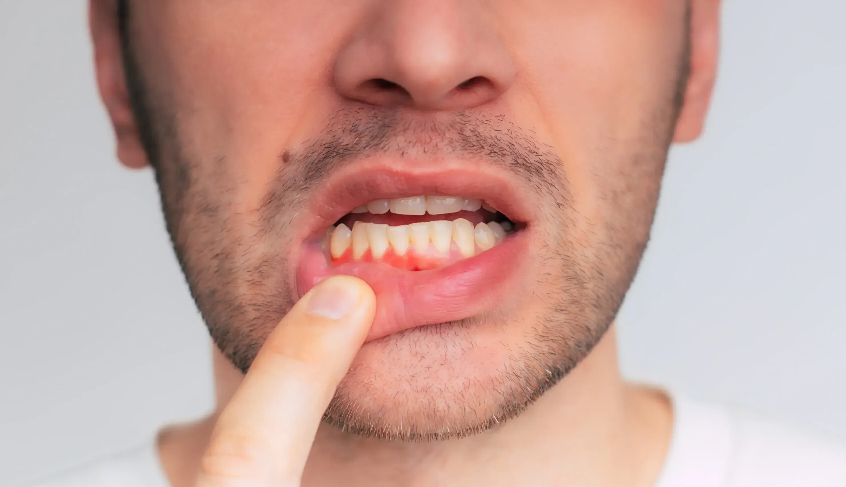 Patient with tooth sensitivity reaching for cheek at East Ellijay Family & Cosmetic Dentistry