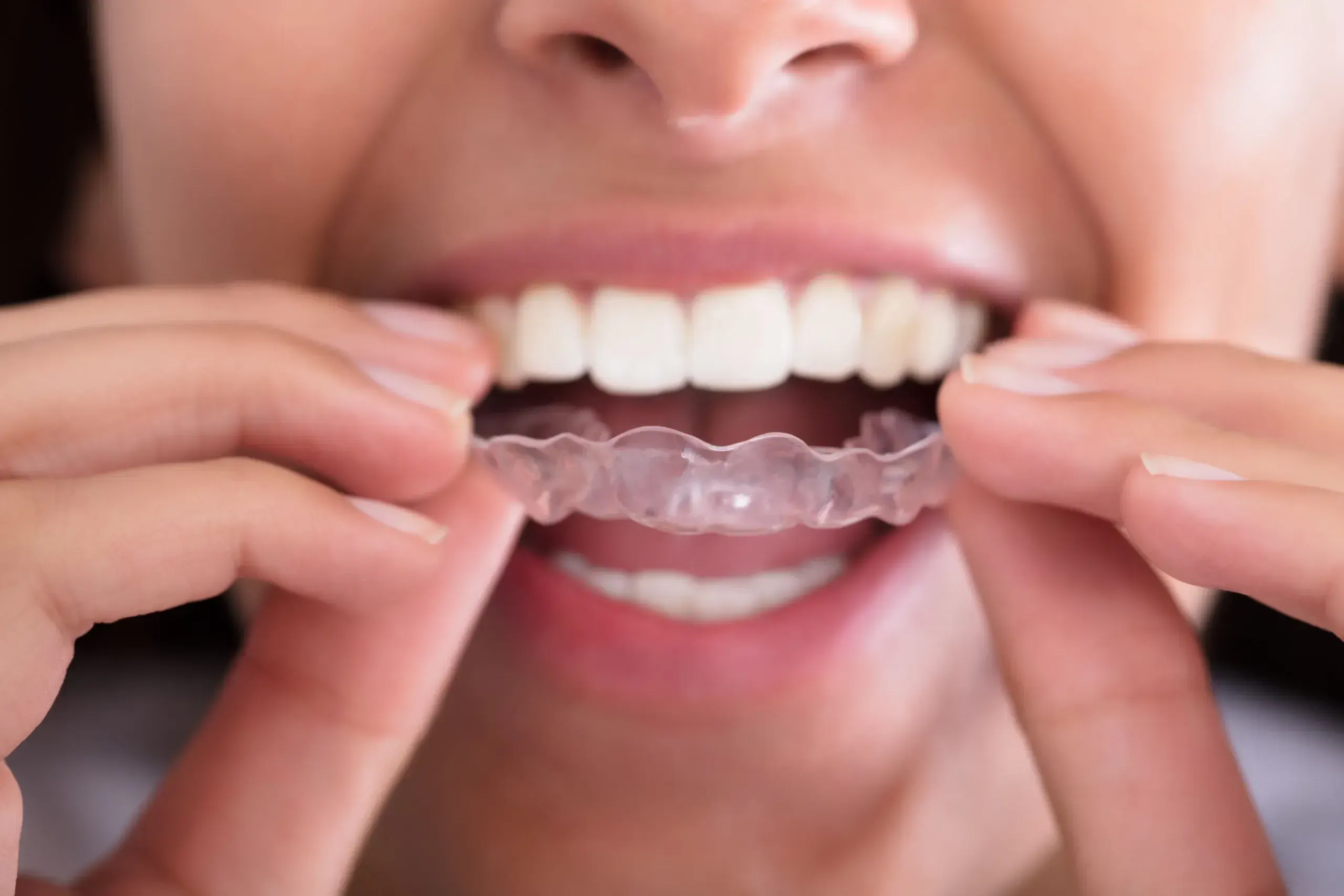 Patient discussing teeth grinding concerns at East Ellijay Family and Cosmetic Dentistry