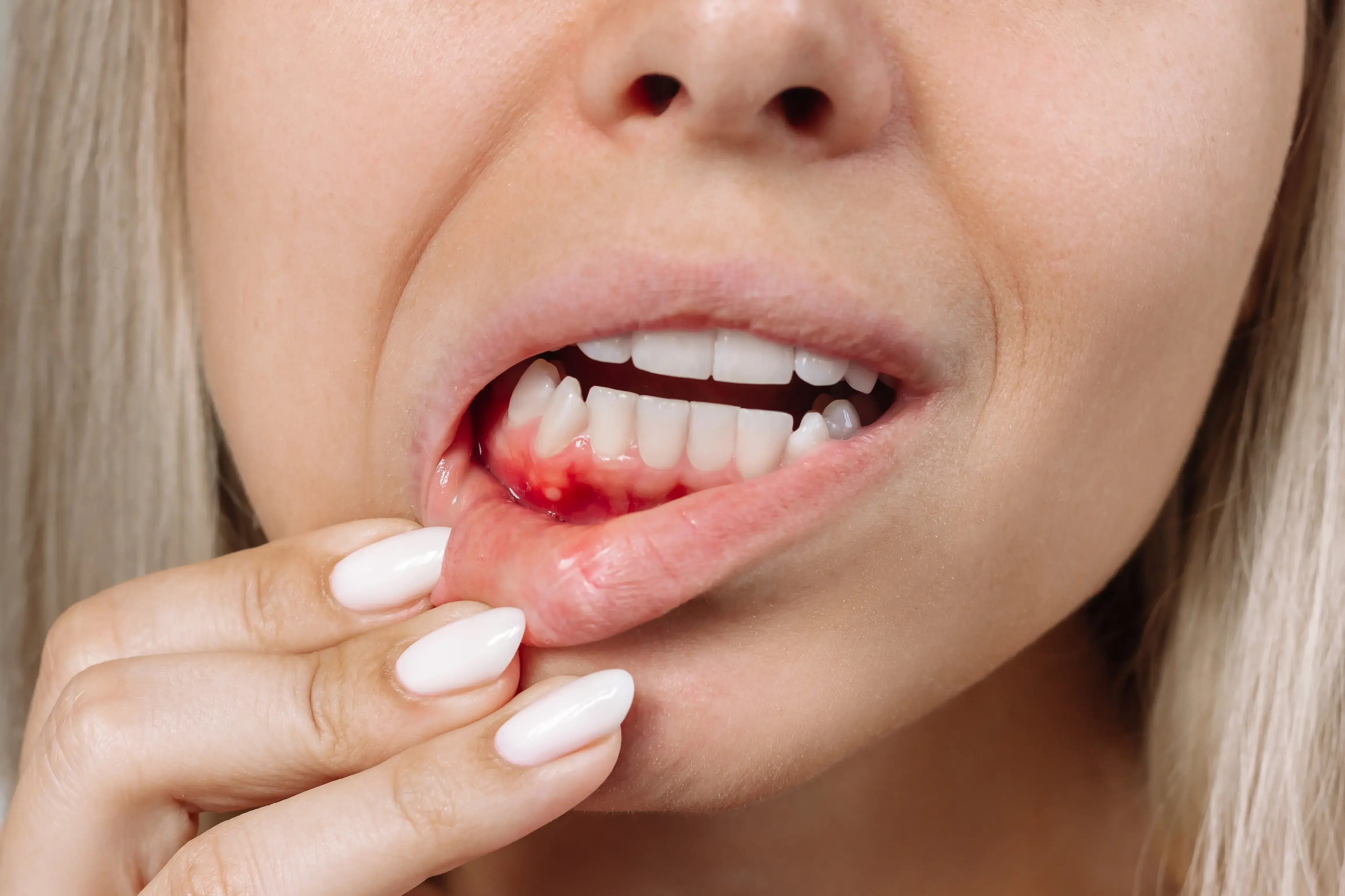 Don't Ignore the Signs of Gum Disease