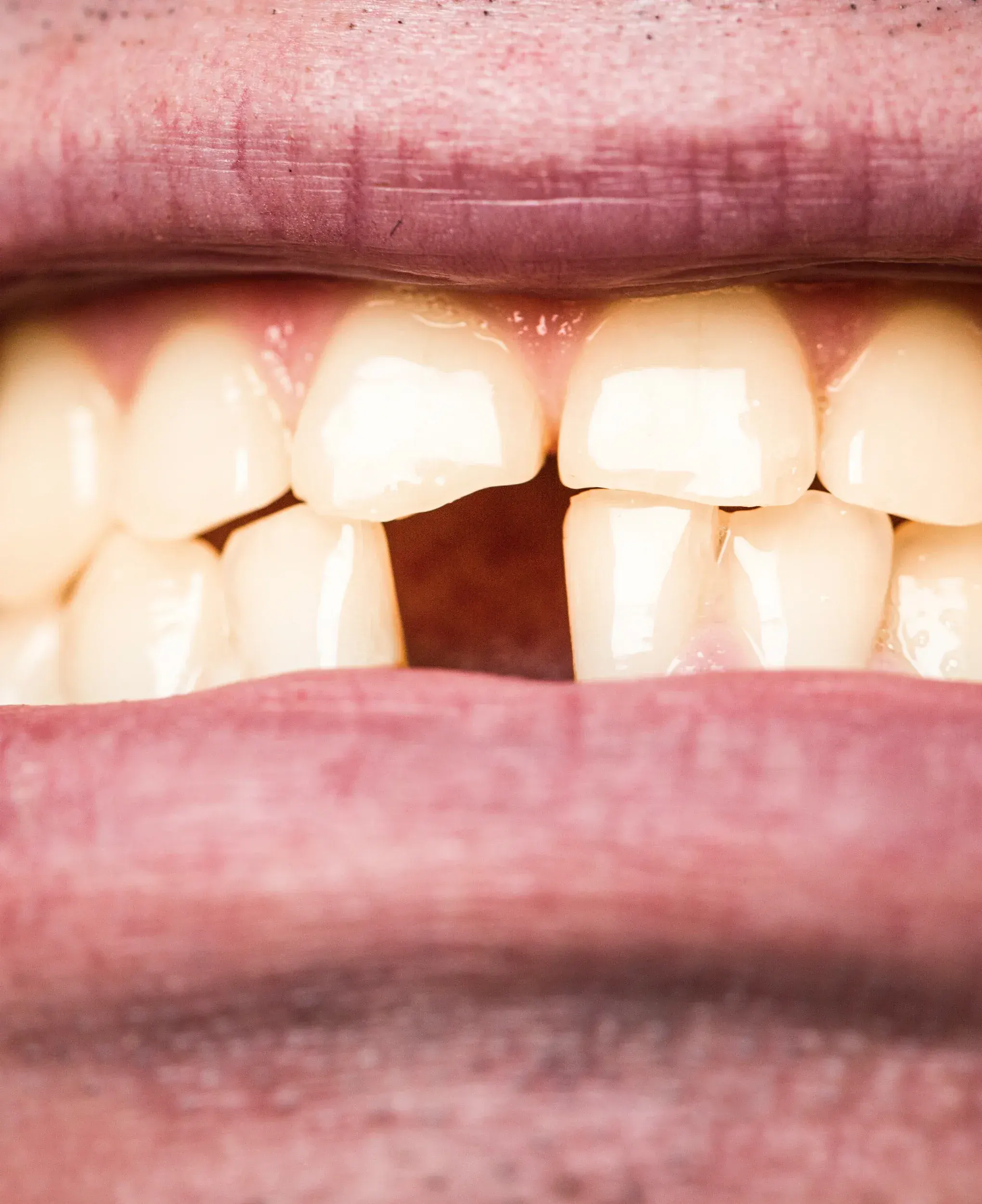 Patient concerned about tooth pain at East Ellijay Family & Cosmetic Dentistry